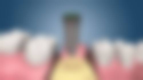 【北京泰康拜博口腔医院东城口腔门诊部特色项目：】