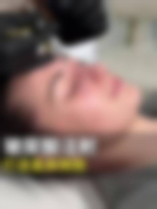 玻尿酸填充价格大揭秘！解锁不同品牌、部位填充背后的价格逻辑与性价比秘诀