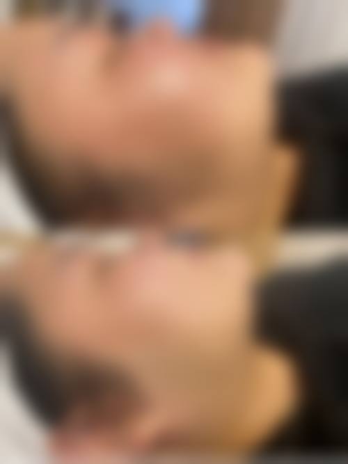 大连爱德丽格医美小腿脱毛价格 579 元起预约挂号方式