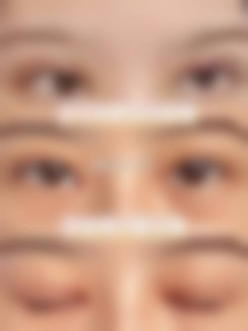 大连爱德丽格医美切开双眼皮价格1835元起，技术优服务好口碑棒，赶紧预约开启迷人双眼皮之旅！ 