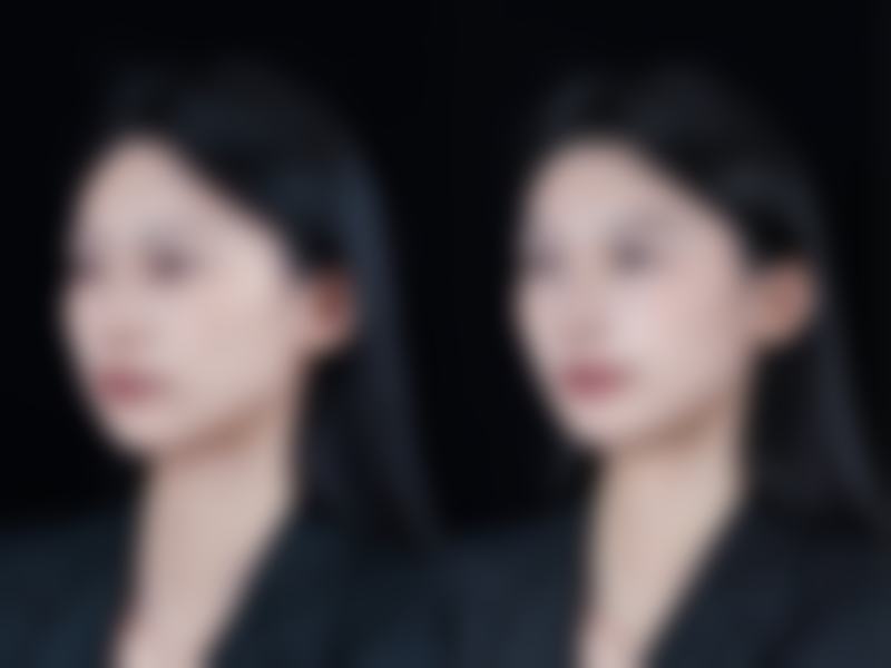 【河南新乡东芳美医美怎么预约挂号?】