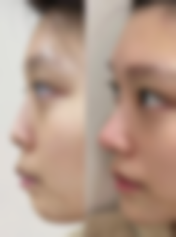 【南京艺星整形美容医院是正规的吗?】