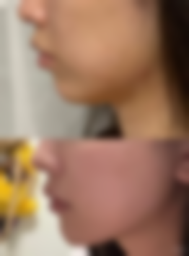 【南京艺星整形美容医院患者口碑评价：】