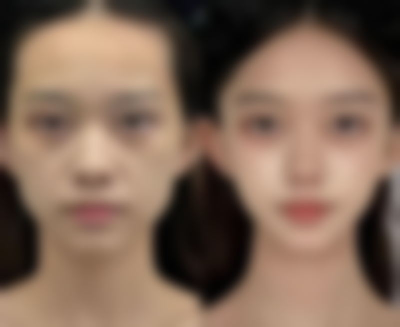 【揭阳爱美诗整形医院核心优势：】