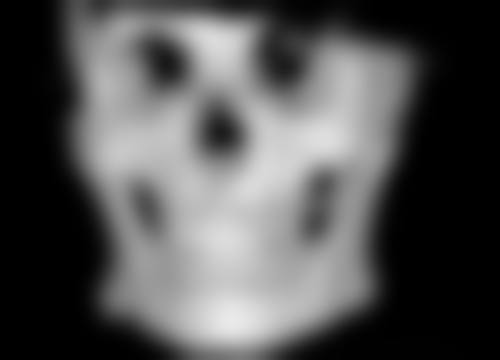 打瘦脸针老了以后的影响