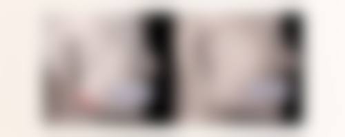 如何选择适合自己的阴道紧缩方法