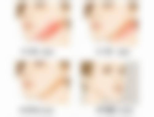 打了溶脂和瘦脸针多久有效果？一文读懂普遍见效时间、影响因素及快速显效小妙招！ 