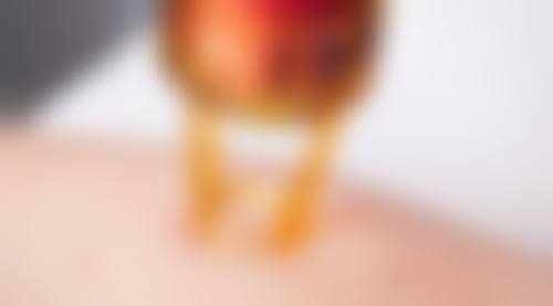 丰太阳穴可以永久吗？揭秘3种常见方式效果时长，自体脂肪移植或能实现长期饱满！ 