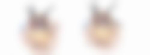 阴道紧缩手术成效怎么样