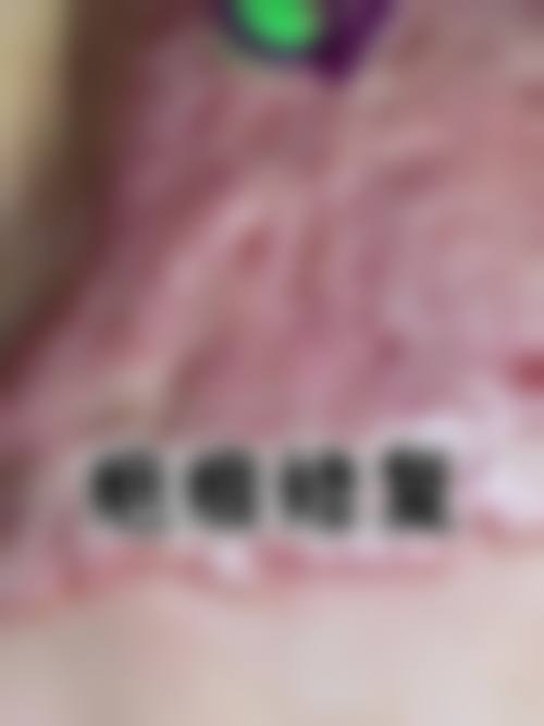 【南京伊尔美医疗整形美容医院特色项目：】