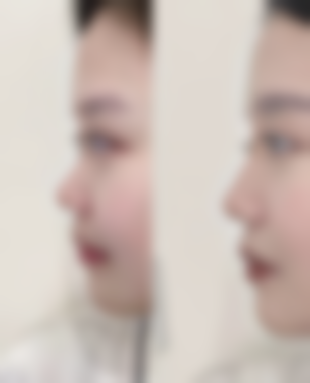 【深圳刘运奇医疗美容门诊部患者口碑评价：】