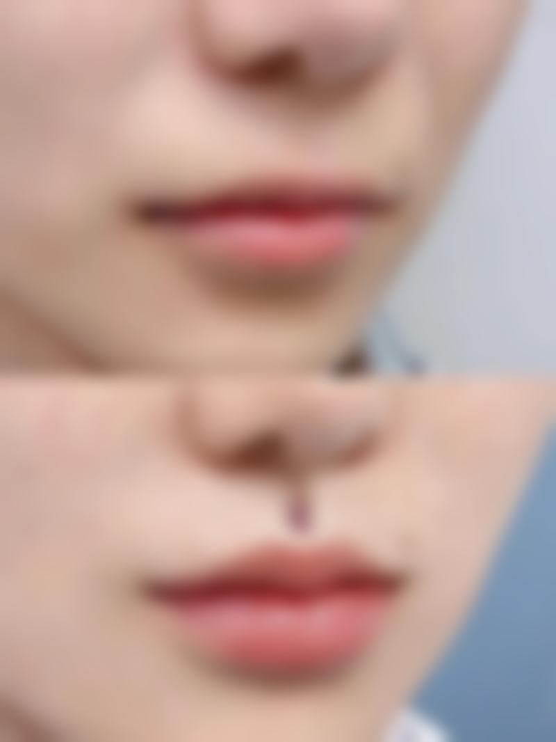 【山西煤炭中 心医院美容整形科诊疗设备：】