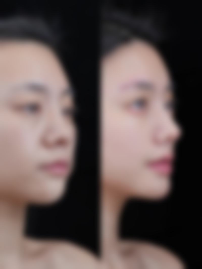 【张宝林医生技术特点:】