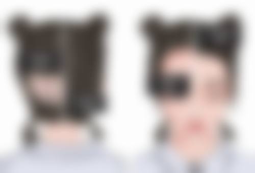 瘦脸针打完多久成效更明显