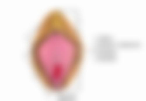 阴式子宫切除 + 阴道前后壁修补术