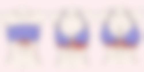 【李东镇医生技术特点：】