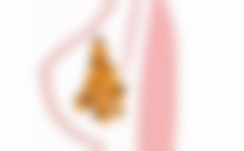 瘦脸针加v脸是提拉紧致的嘛