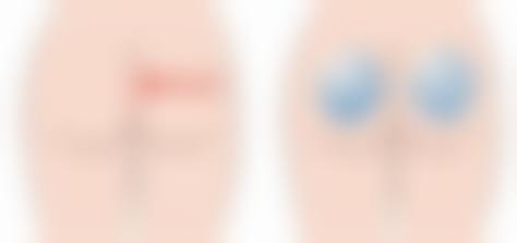 【王文彦医生擅长项目】