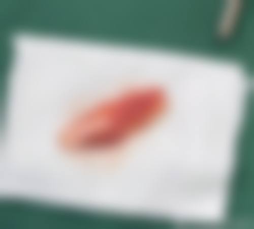 【李东镇医生擅长项目】