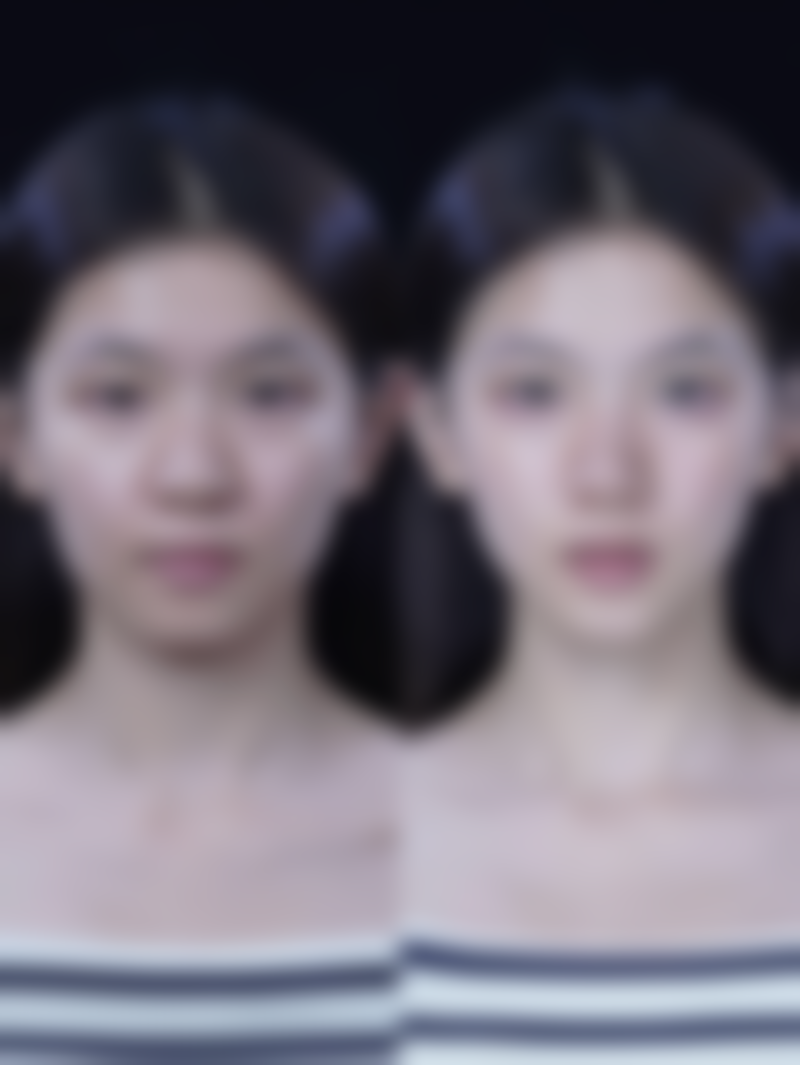 美白针哪个牌子成效更好