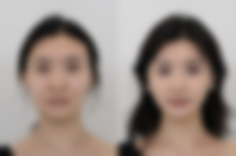 种植头发可靠吗成效好吗