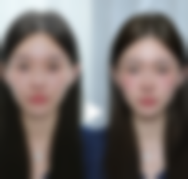 打美白针是全身白吗能管多久？