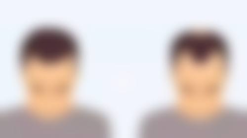 打瘦脸针要素颜去打吗？揭秘素颜打瘦脸针的3大关键好处，让你美出新高度！ 