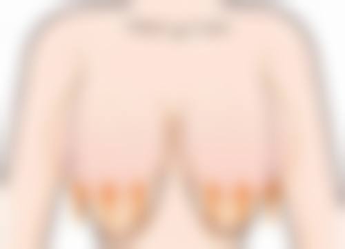 做阴道紧缩有副作用吗