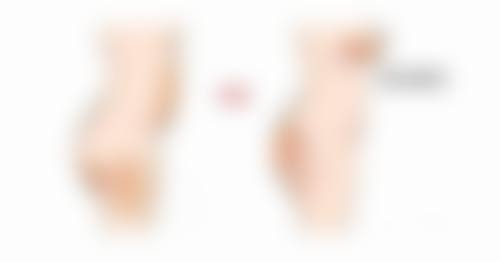 苹果肌打瘦脸针有用吗？