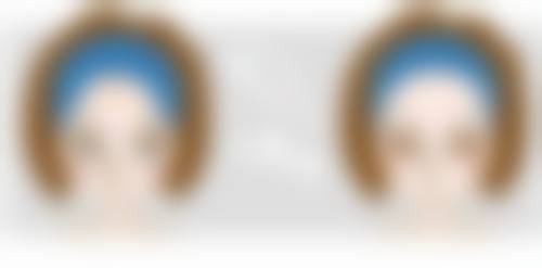 瘦脸针打几次可以恒久定型