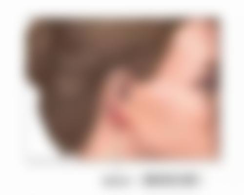 苹果肌上可以打瘦脸针吗？资深医美专家揭秘打与不打的关键因素及惊人效果差异！ 