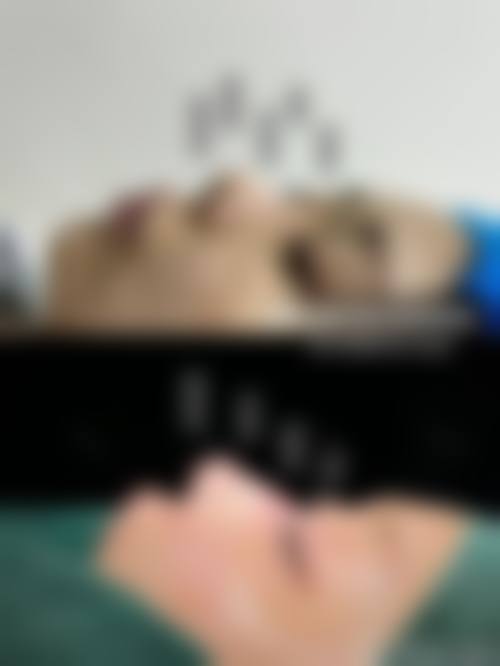 【张宝林医生技术特点】