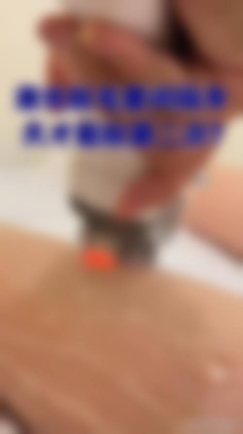 【莫丽仙医生口碑】