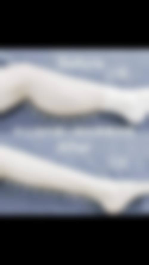 【郑元均医生技术特点】