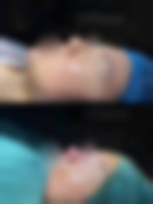 【张宝林医生口碑怎么样？】