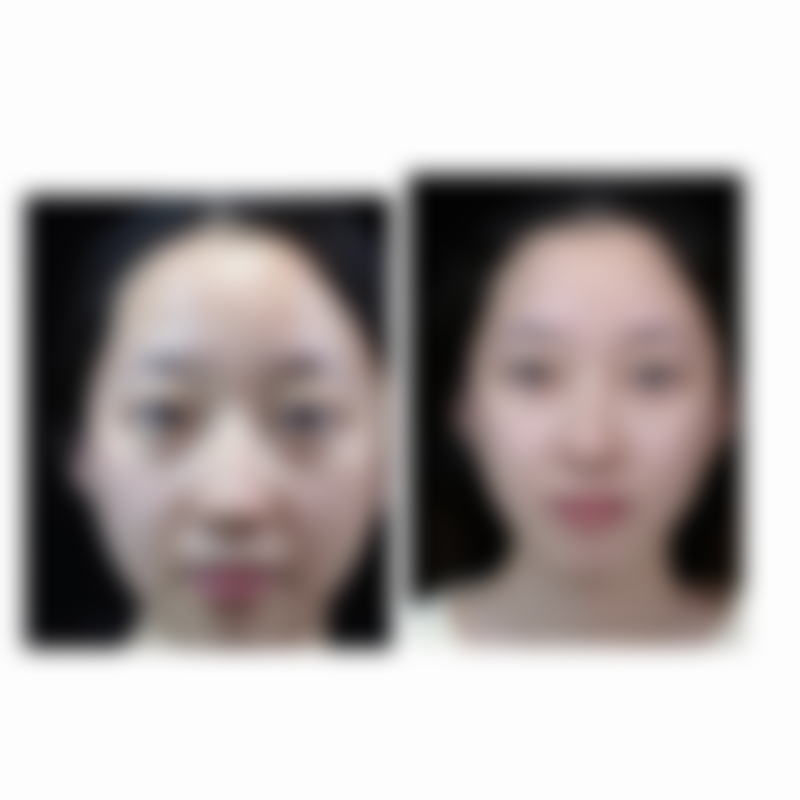 【北京美易美时代整形医院患者口碑评价：】