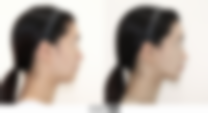 【詹卫群医生口碑】