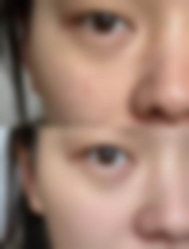 瘦脸针多少钱一针