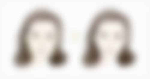 打瘦脸针真能瘦脸吗