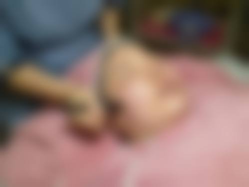 【深圳华美整形医院诊疗设备:】