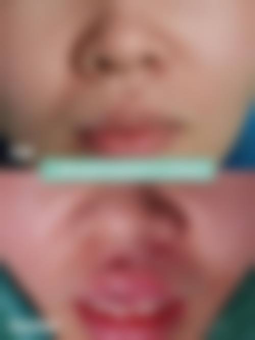 【南充新韵悦美整形医院是正规的吗?】