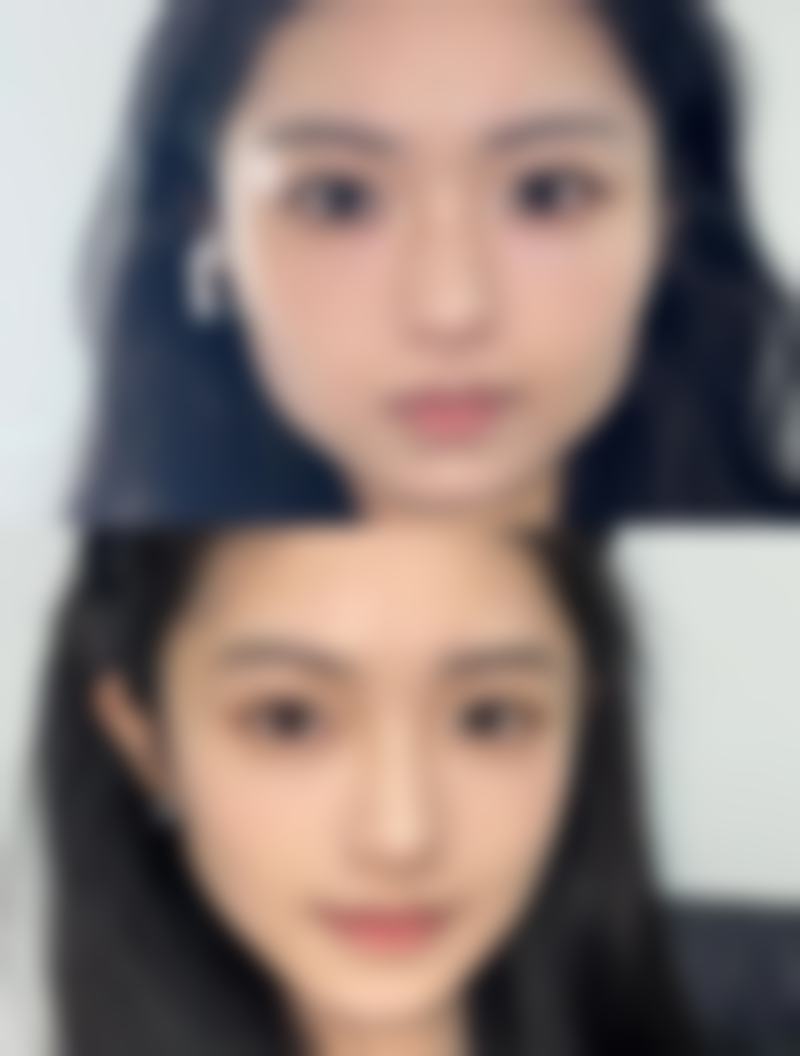 【韶关涵美医疗美容医院怎么预约挂号?】