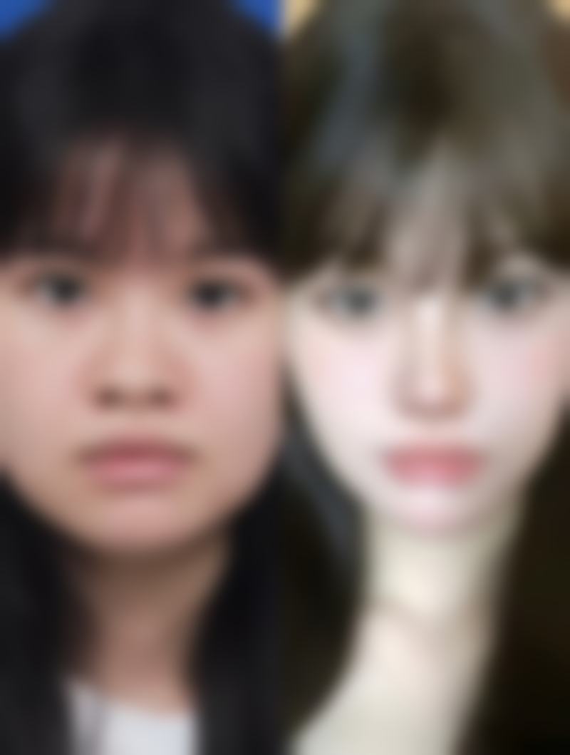 【南京米尚恩整形医院参考价格表：】