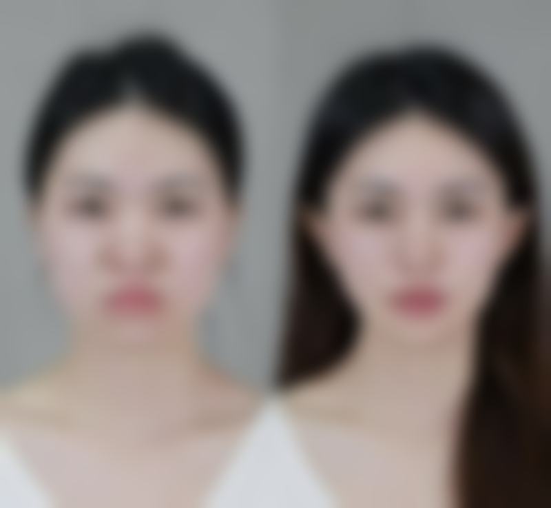 【肖林华医生技术特点】