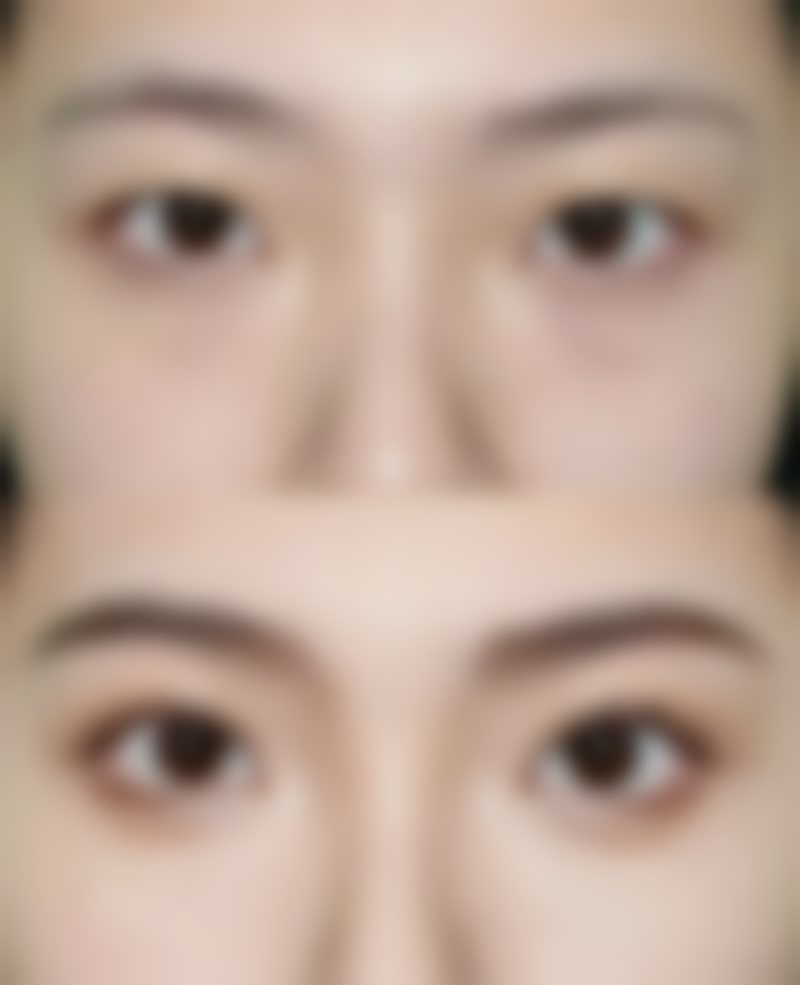 【沈阳悦美格美医疗美容诊所参考价格表：】