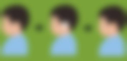 除皱针：快速见效的抗皱利器