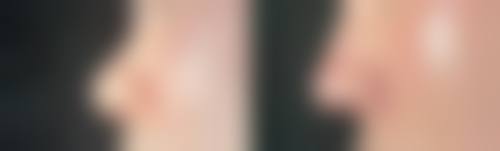 【世檀塔男科医院特色项目：】