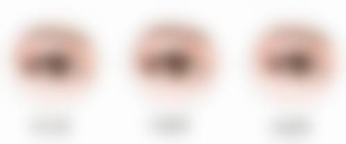 毛囊种植会掉吗