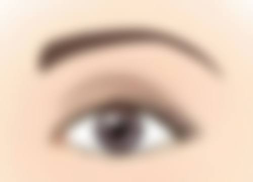 种植头发后种植的头发会掉完吗