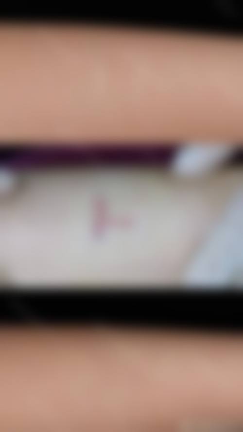 【福清天宝美容整形医院诊疗设备：】